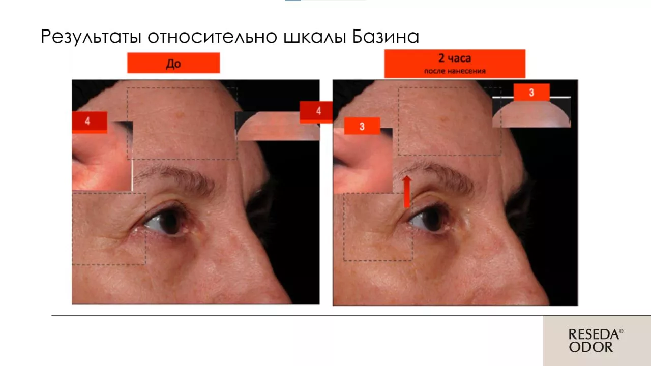 Сыворотка омолаживающая "Mio Control". Rejuvenating Serum "Mio Control" (CLINIC)