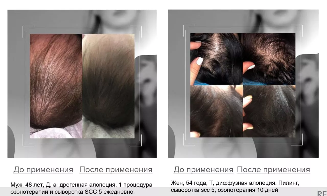 SCC 5 Комплекс для укрепления и восстановления волос. SCC 5 - Strength & Restore Hair Treatment Complex