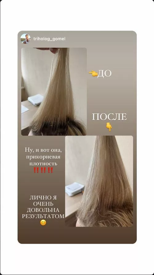 SCC 5 Комплекс для укрепления и восстановления волос. SCC 5 - Strength & Restore Hair Treatment Complex