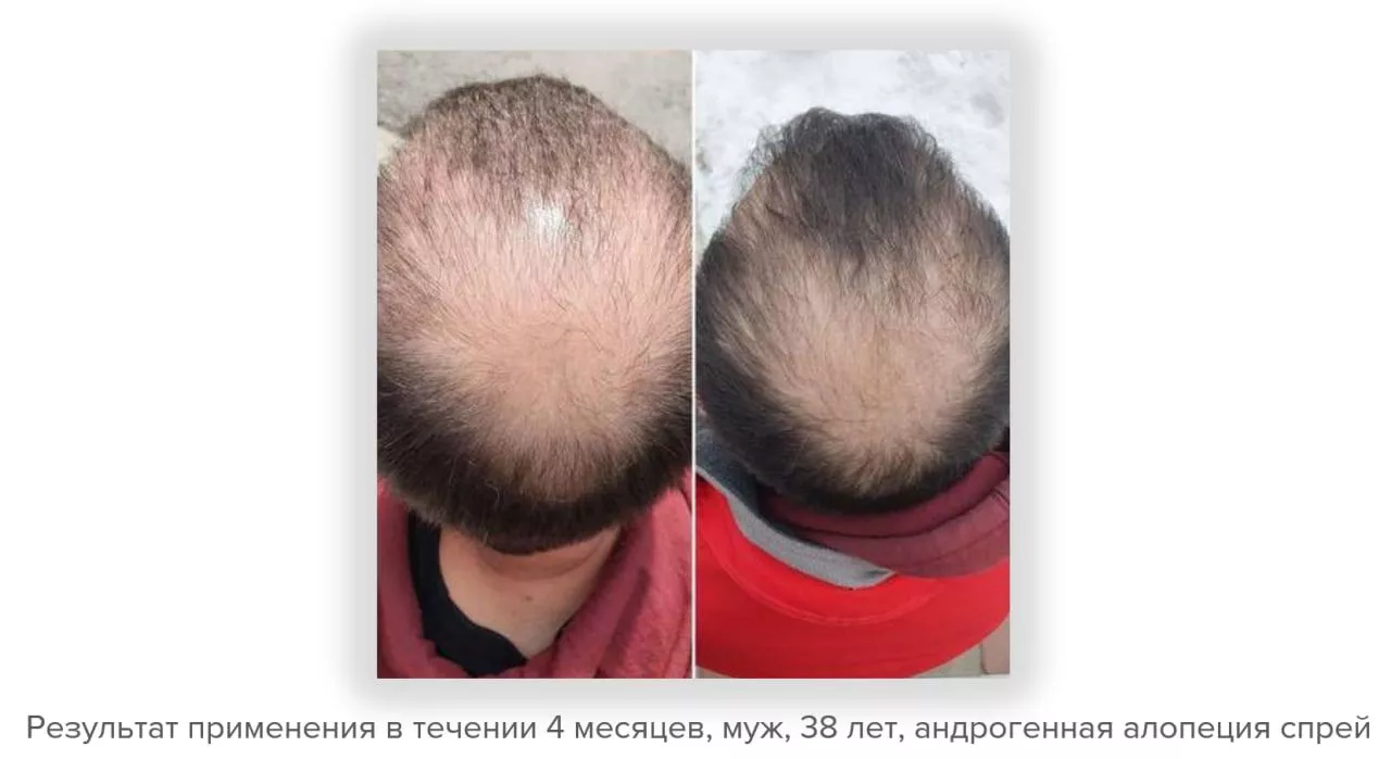 SCC 5 Комплекс для укрепления и восстановления волос. SCC 5 - Strength & Restore Hair Treatment Complex