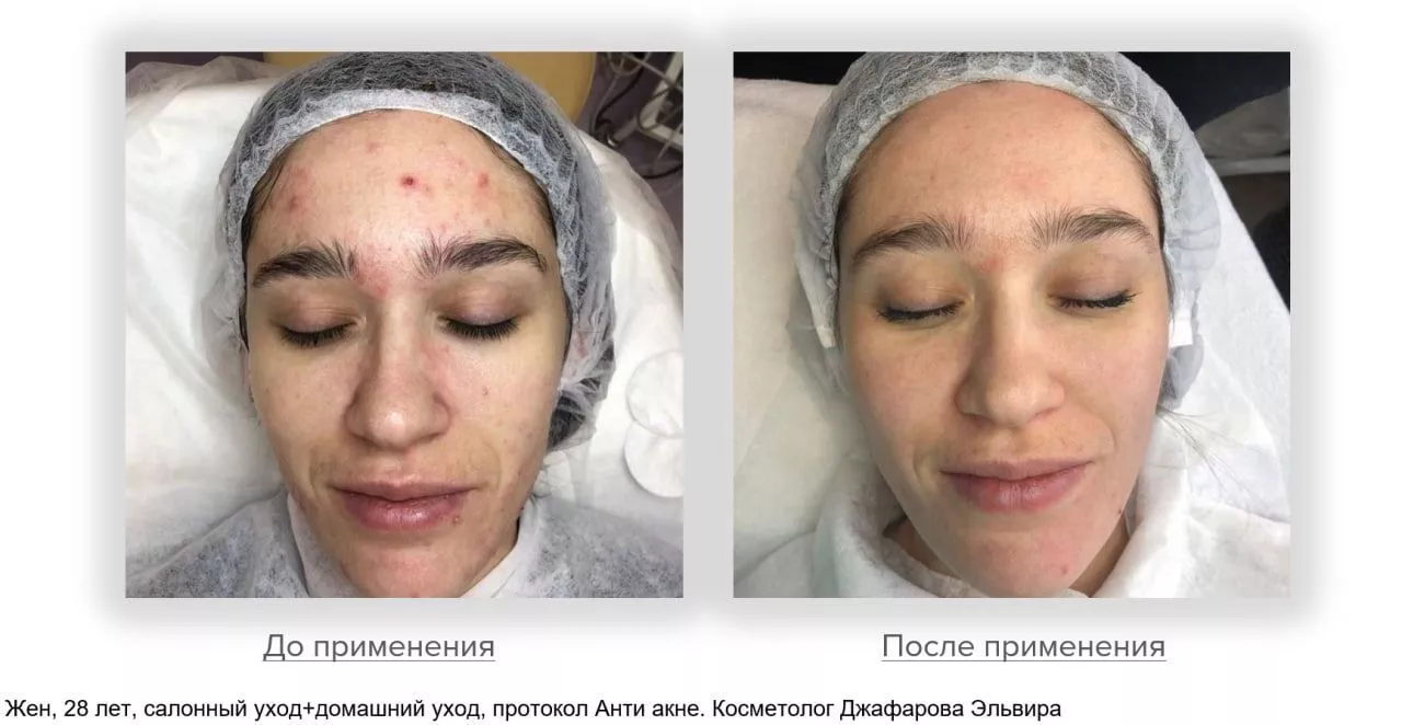 Мягкий очищающий гель Gentle Cleanser Free From Malassezia