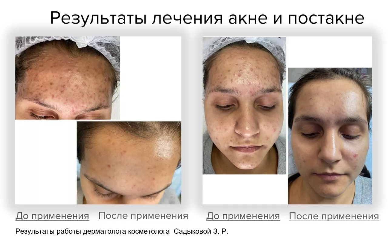 Мягкий очищающий гель Gentle Cleanser Free From Malassezia