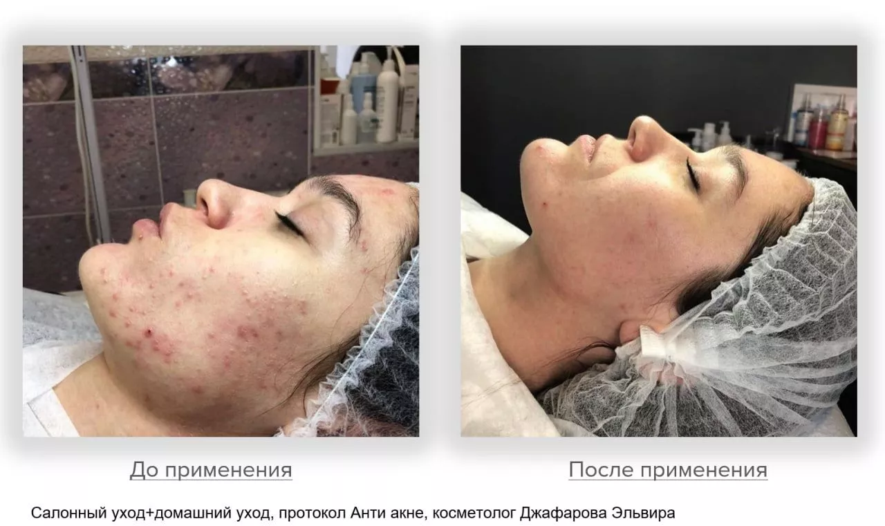 Мягкий очищающий гель Gentle Cleanser Free From Malassezia