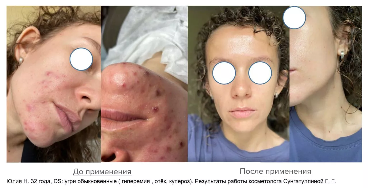 Мягкий очищающий гель Gentle Cleanser Free From Malassezia