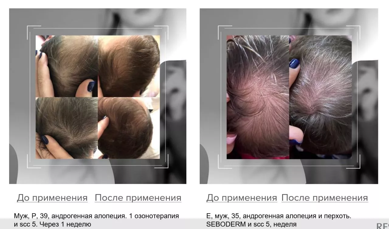 SCC 5 Комплекс для укрепления и восстановления волос. SCC 5 - Strength & Restore Hair Treatment Complex