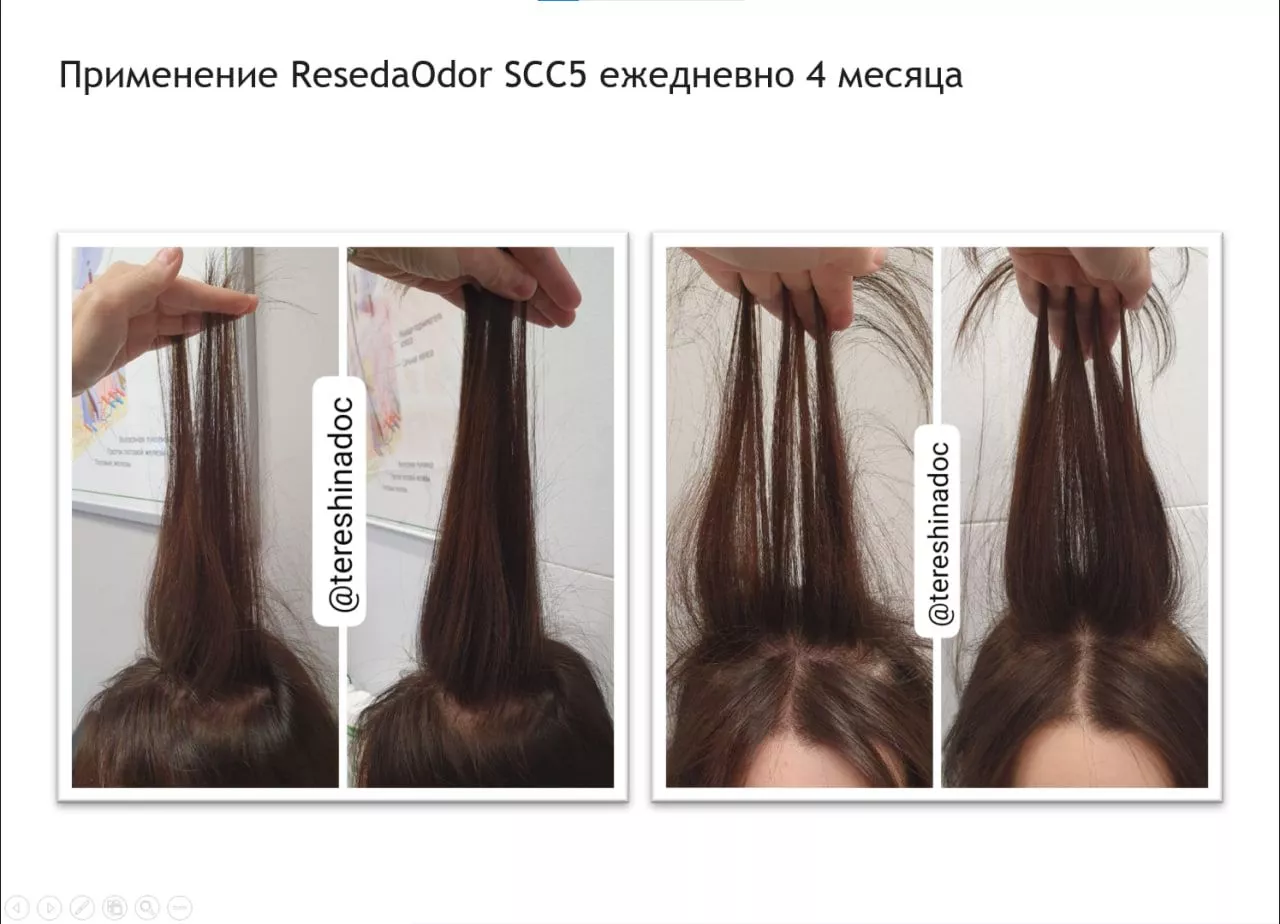 SCC 5 Комплекс для укрепления и восстановления волос. SCC 5 - Strength & Restore Hair Treatment Complex