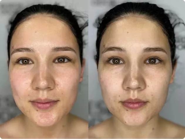 Мягкий очищающий гель Gentle Cleanser Free From Malassezia