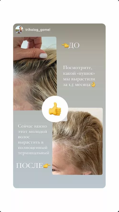 SCC 5 Комплекс для укрепления и восстановления волос. SCC 5 - Strength & Restore Hair Treatment Complex