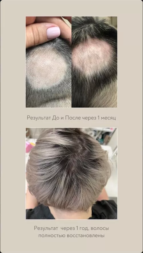 SCC 5 Комплекс для укрепления и восстановления волос. SCC 5 - Strength & Restore Hair Treatment Complex