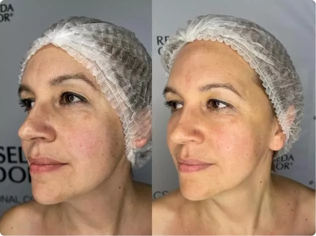 Мягкий очищающий гель Gentle Cleanser Free From Malassezia