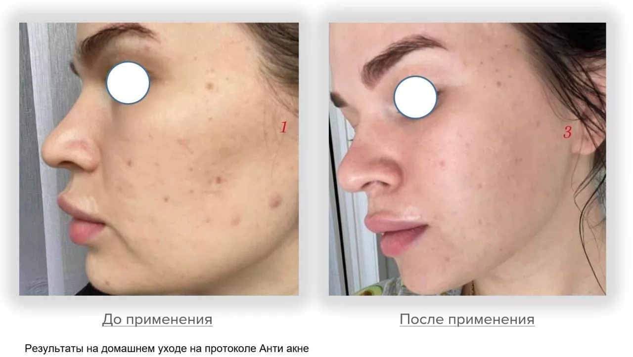 Мягкий очищающий гель Gentle Cleanser Free From Malassezia