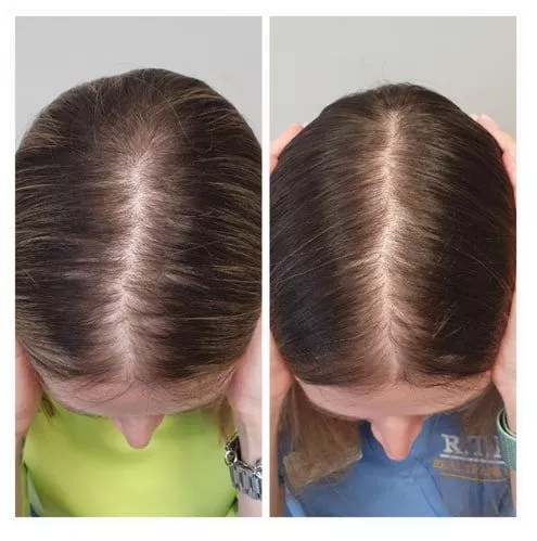 SCC 5 Комплекс для укрепления и восстановления волос. SCC 5 - Strength & Restore Hair Treatment Complex