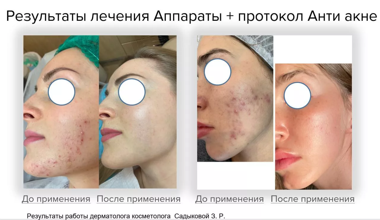 Мягкий очищающий гель Gentle Cleanser Free From Malassezia