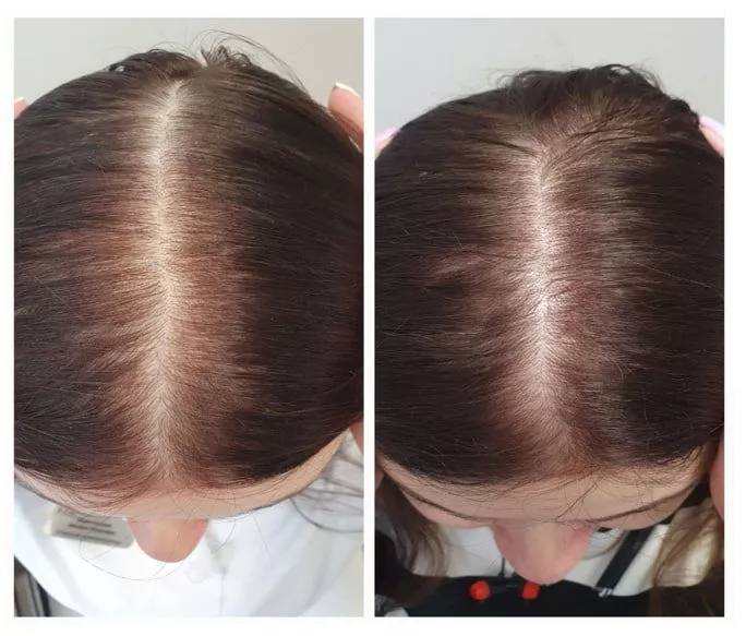 SCC 5 Комплекс для укрепления и восстановления волос. SCC 5 - Strength & Restore Hair Treatment Complex