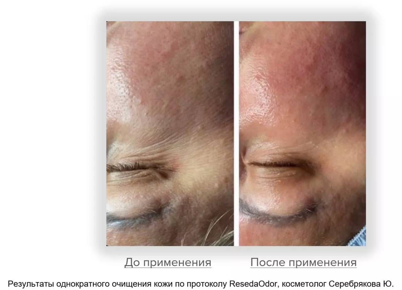 Мицеллярная вода. Micellar Water