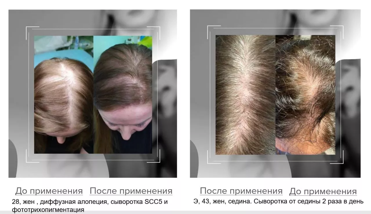 SCC 5 Комплекс для укрепления и восстановления волос. SCC 5 - Strength & Restore Hair Treatment Complex