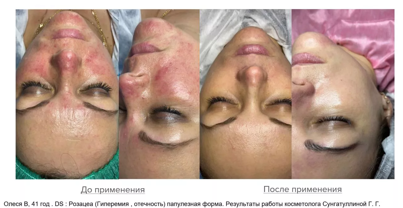 Мицеллярная вода. Micellar Water