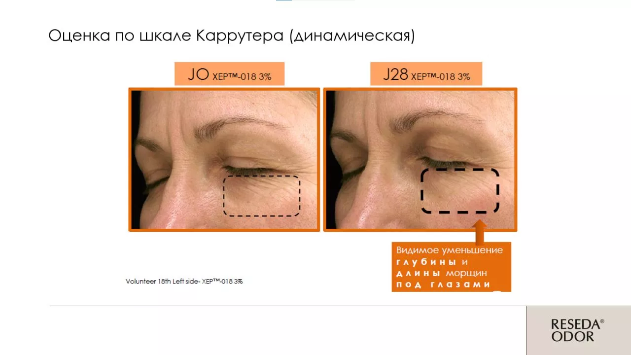 Сыворотка омолаживающая "Mio Control". Rejuvenating Serum "Mio Control" (CLINIC)