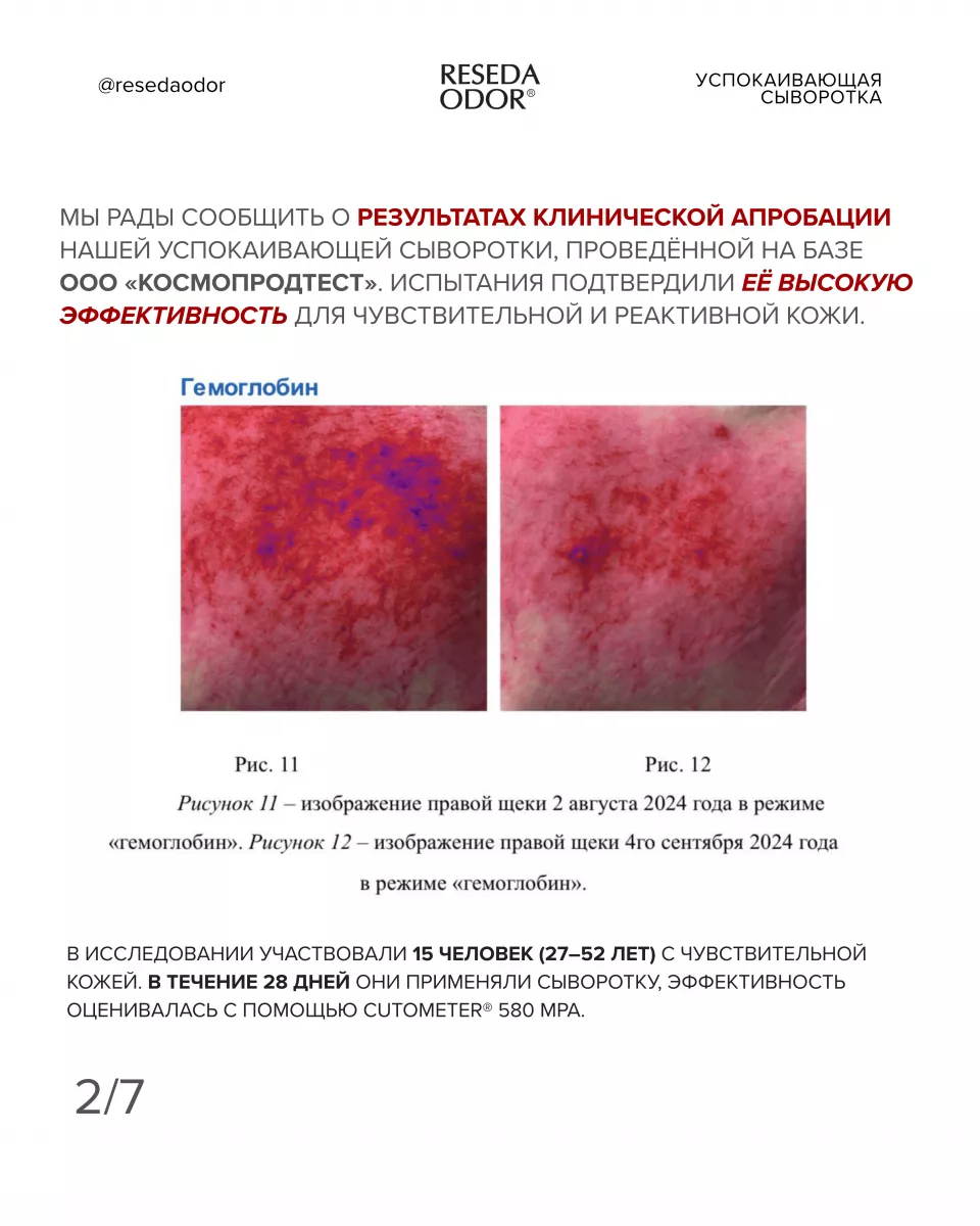 Сыворотка успокаивающая для чувствительной кожи. Sensitive Skin Soothing Serum (CLINIC) - resedaodor.com