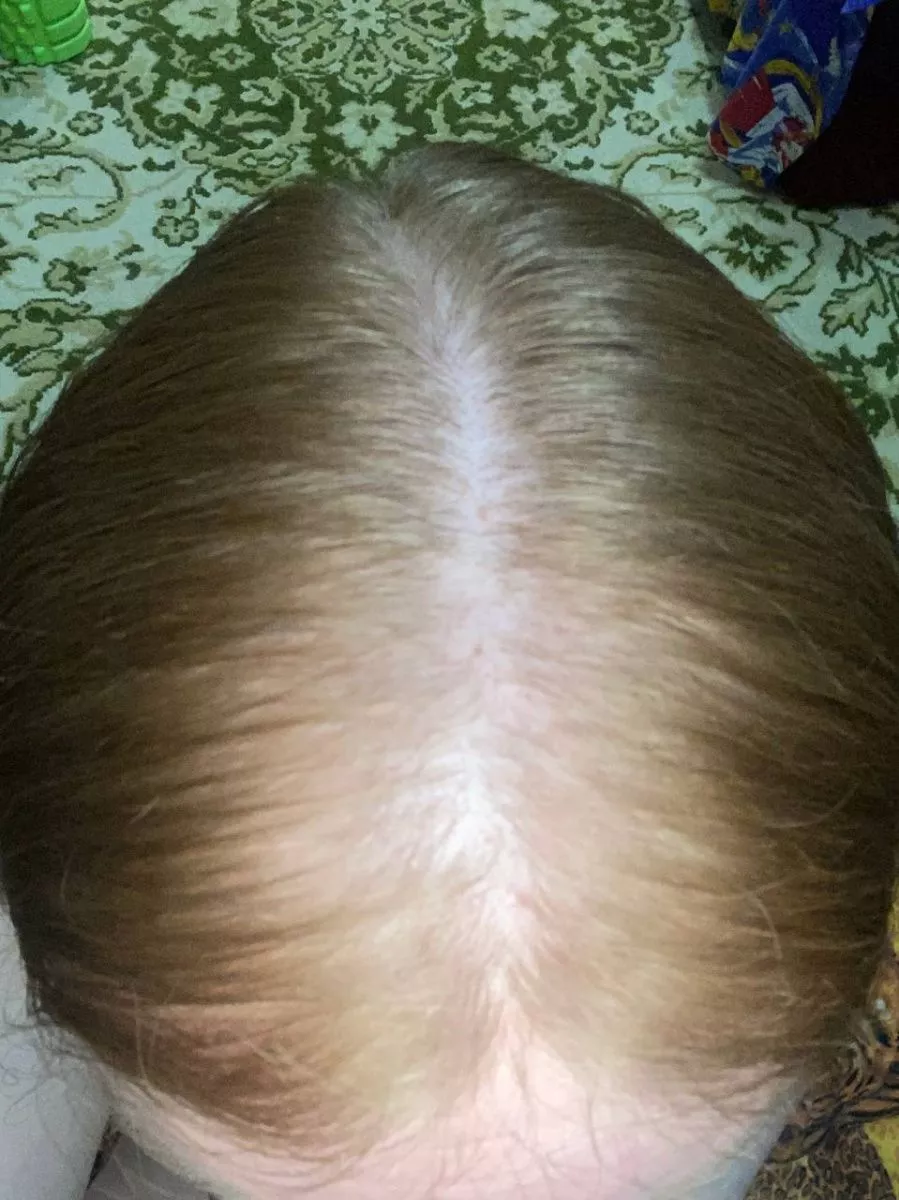 SCC 5 Комплекс для укрепления и восстановления волос. SCC 5 - Strength & Restore Hair Treatment Complex