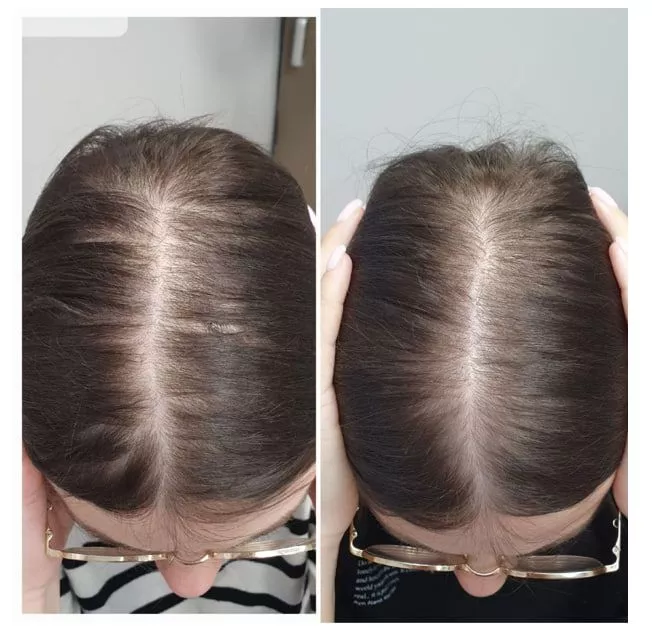 SCC 5 Комплекс для укрепления и восстановления волос. SCC 5 - Strength & Restore Hair Treatment Complex