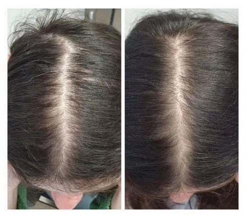SCC 5 Комплекс для укрепления и восстановления волос. SCC 5 - Strength & Restore Hair Treatment Complex