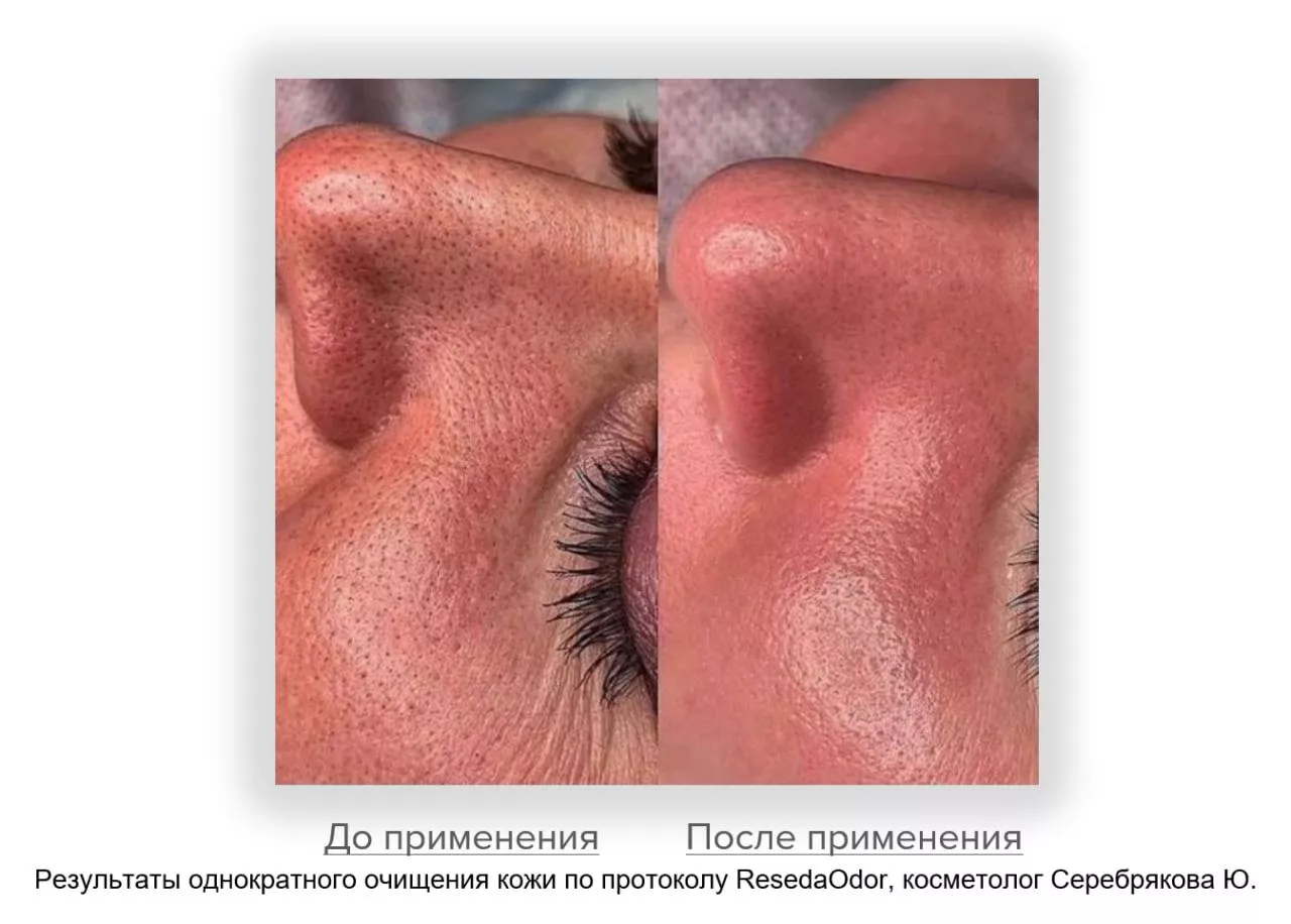 Мицеллярная вода. Micellar Water