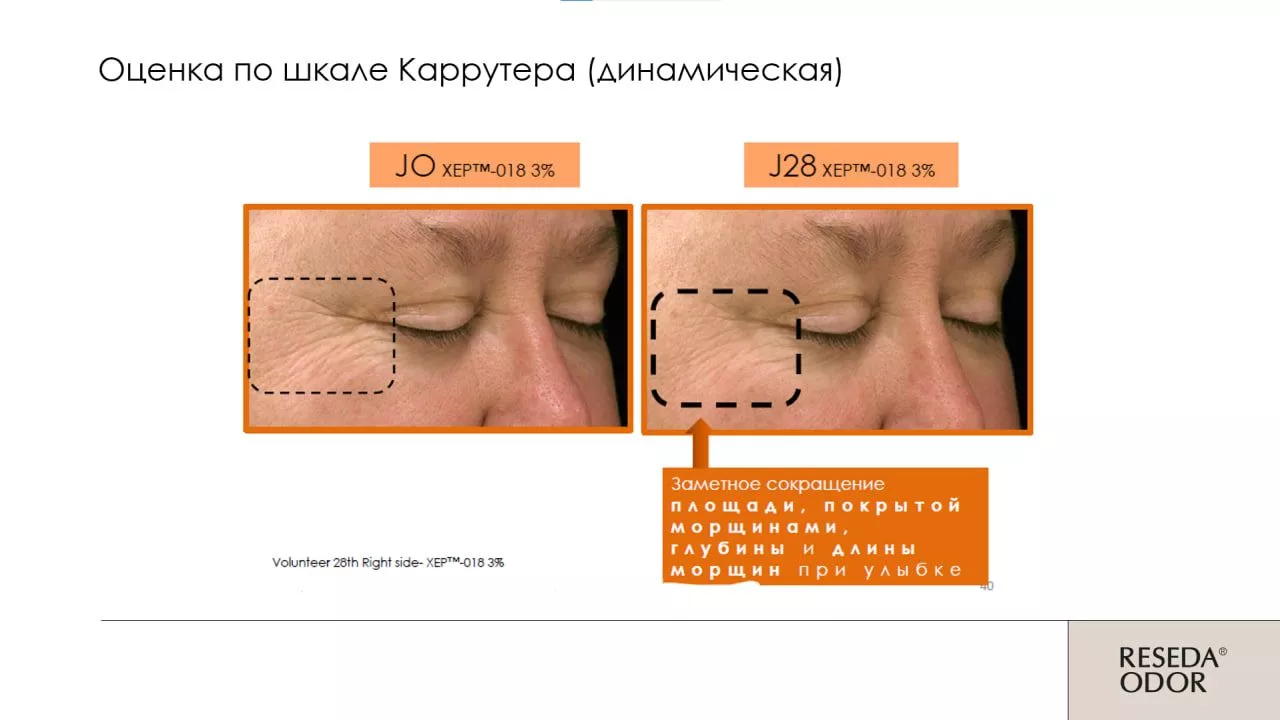 Сыворотка омолаживающая "Mio Control". Rejuvenating Serum "Mio Control" (CLINIC)