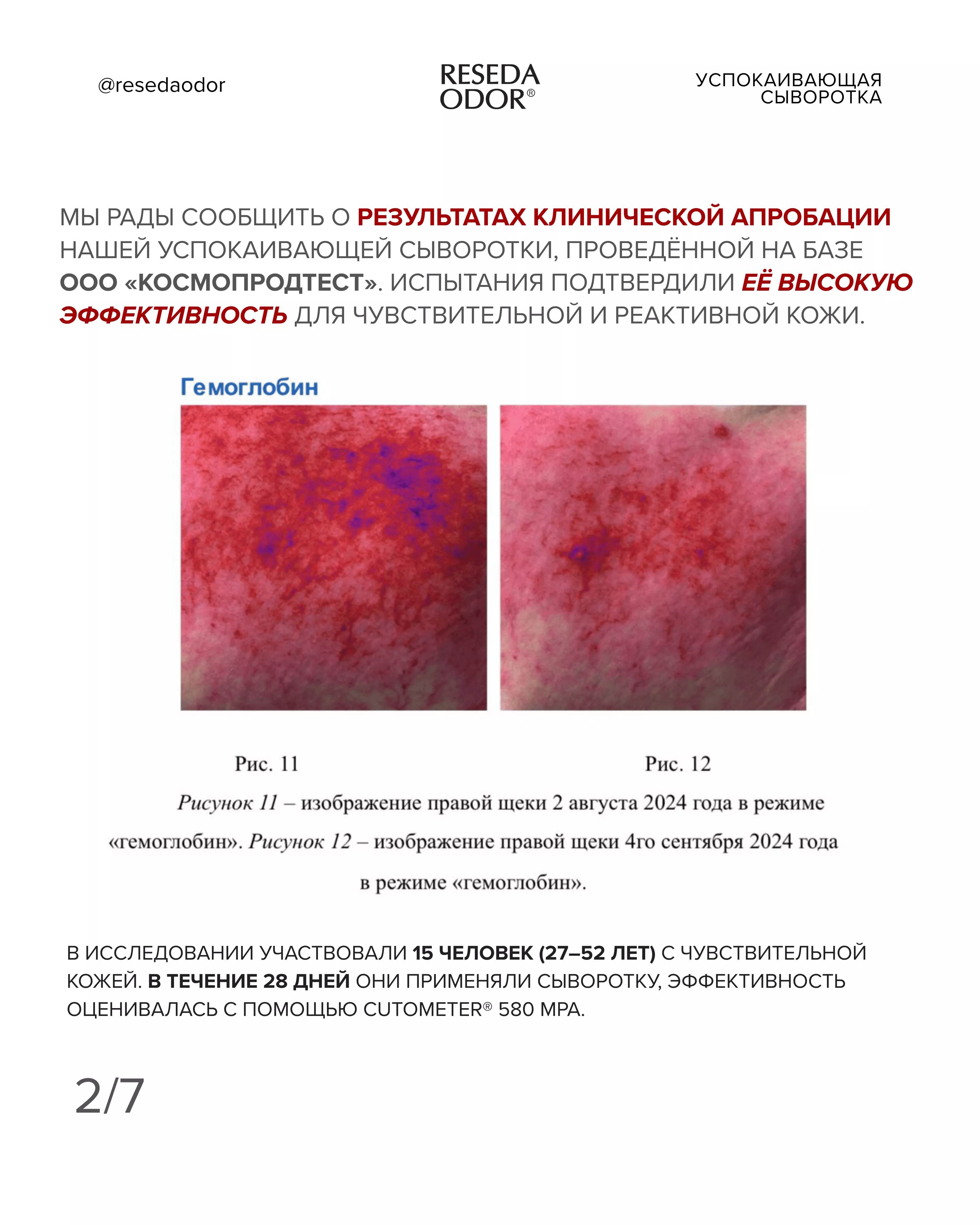 Сыворотка успокаивающая для чувствительной кожи. Sensitive Skin Soothing Serum (CLINIC) - resedaodor.com