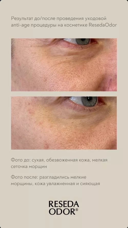 Лифтинг-крем для кожи вокруг глаз. Lifting Eye Cream