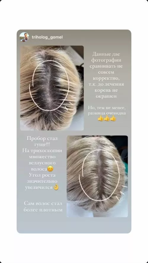 SCC 5 Комплекс для укрепления и восстановления волос. SCC 5 - Strength & Restore Hair Treatment Complex