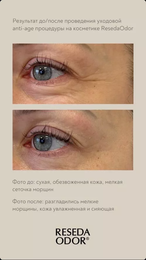 Лифтинг-крем для кожи вокруг глаз. Lifting Eye Cream Updated Format