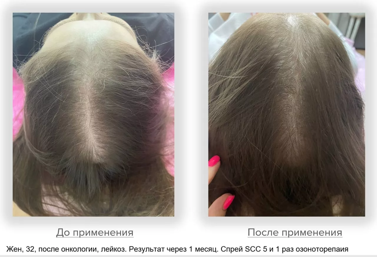 SCC 5 Комплекс для укрепления и восстановления волос. SCC 5 - Strength & Restore Hair Treatment Complex
