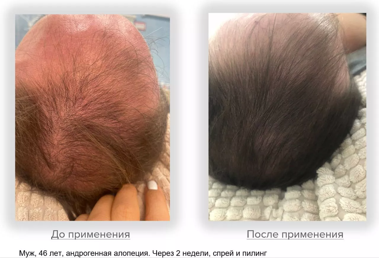 SCC 5 Комплекс для укрепления и восстановления волос. SCC 5 - Strength & Restore Hair Treatment Complex