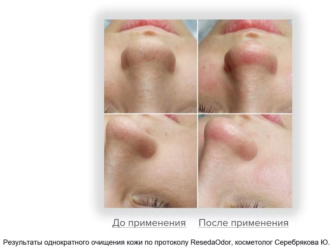 Мицеллярная вода. Micellar Water