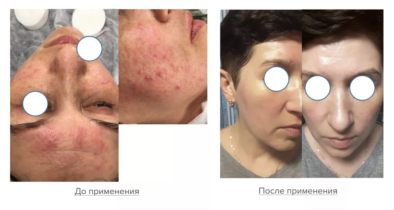 Мягкий очищающий гель Gentle Cleanser Free From Malassezia