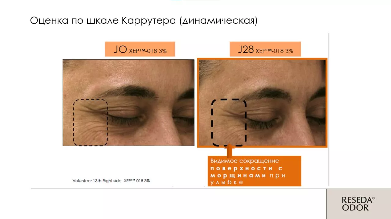 Сыворотка омолаживающая "Mio Control". Rejuvenating Serum "Mio Control" (CLINIC)