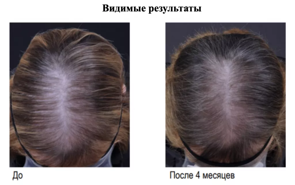 Снимок экрана 2026-02-26 в 21.35.56.png