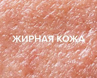 Комплексное решение для жирной кожи с расширенными порами