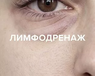 Комплексное решение для активации микроциркуляции и лимфодренажа