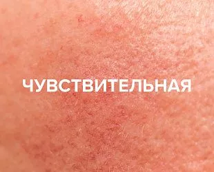 Комплексное решение для чувствительной кожи 